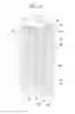 Fig. 22 - Liquid crystal display device