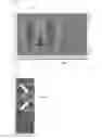 Fig. 13 - LIQUID CRYSTAL DISPLAY DEVICE