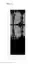 Fig. 15 - LIQUID CRYSTAL DISPLAY DEVICE