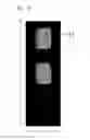 Fig. 25 - LIQUID CRYSTAL DISPLAY DEVICE