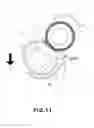 Fig. 12 - Fixing device having fixing nip formed by elastic roller and a back-up unit with cylindrical film and film guide including a plurality of ribs extending circumferentially along the inner periphery of the film