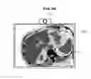 Fig. 11 - Ultrasonic apparatus and method of controlling the same