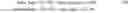 Fig. 06 - Dynamic calibrating of a touch-screen-implemented virtual braille keyboard