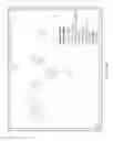 Fig. 08 - Dynamic calibrating of a touch-screen-implemented virtual braille keyboard