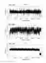 Fig. 35 - METHODS AND PROCESSES FOR NON-INVASIVE ASSESSMENT OF GENETIC VARIATIONS