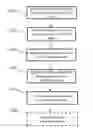 Fig. 01 - Systems and methods for creating hair transplantation procedure sites