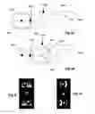 Fig. 08 - Systems and methods for creating hair transplantation procedure sites