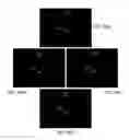 Fig. 23 - Dendritic structures and tags