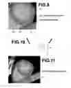 Fig. 06 - Curved line correction apparatus, method, and medium
