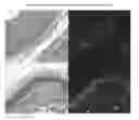 Fig. 01 - Automated placental measurement
