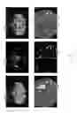 Fig. 10 - Method for detecting and quantifying cerebral infarct