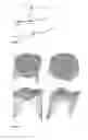 Fig. 03 - Semi-automated heart valve morphometry and computational stress analysis from 3D images