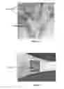 Fig. 03 - Method of determining an indicator for the stability of a bone implant
