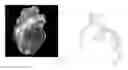 Fig. 01 - Method and a system for registering a 3D pre acquired image coordinate system with a medical positioning system coordinate system and with a 2D image coordinate system