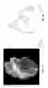 Fig. 02 - Method and a system for registering a 3D pre acquired image coordinate system with a medical positioning system coordinate system and with a 2D image coordinate system
