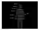 Fig. 01 - Systems and methods for detecting a tilt angle from a depth image