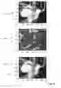 Fig. 10 - Vessel segmentation