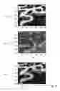 Fig. 11 - Vessel segmentation