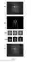 Fig. 64 - Systems, devices, and methods for tracking and compensating for patient motion during a medical imaging scan