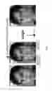 Fig. 11 - 2D image-based 3D glasses virtual try-on system