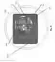 Fig. 61 - Optic for a strobe notification appliance
