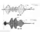 Fig. 09 - Speech dereverberation methods, devices and systems