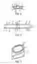 Fig. 05 - Cast Split Low Voltage Coil With Integrated Cooling Duct Placement After Winding Process