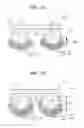 Fig. 03 - Semiconductor component, semiconductor-mounted product including the component, and method of producing the product
