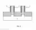 Fig. 03 - finFET having highly doped source and drain regions