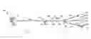 Fig. 01 - Interference Cancellation in Coaxial Cable Connected Data Over Cable Service Interface Specification (DOCSIS) System or Cable Network
