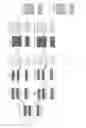 Fig. 04 - Deinterleaving interleaved high dynamic range image by using YUV interpolation