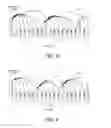 Fig. 04 - Golden frame selection in video coding