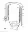 Fig. 04 - INDUCTION HEATING APPARATUS