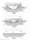 Fig. 10 - Irrigation wheel system