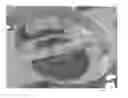 Fig. 01 - Quick-coupling for mower blades