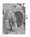 Fig. 05 - Quick-coupling for mower blades