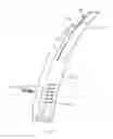 Fig. 16 - Adjustable harness for pet and methods of use