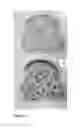 Fig. 02 - DOUGH OR BATTER COMPRISING FUNCTIONALIZED GRAINS