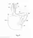 Fig. 10 - System and method for processing slaughtered animals and/or parts thereof