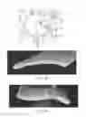 Fig. 05 - CONFECTIONERY PRODUCT CONTAINING ACTIVE AND/OR REACTIVE COMPONENTS AND METHODS OF PRODUCTION THEREOF
