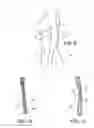 Fig. 09 - Body-shaping intimacy garment