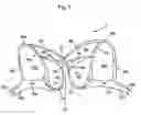 Fig. 02 - METHOD AND APPARATUS FOR IMPROVED BRA