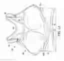 Fig. 02 - Post-surgical garment
