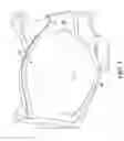 Fig. 07 - Post-surgical garment