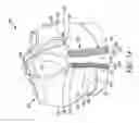 Fig. 16 - Post-surgical garment