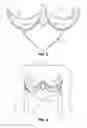 Fig. 03 - Cantilevered breast support