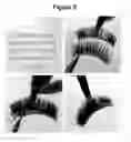 Fig. 07 - CASCADING EYELASHES