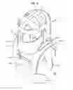 Fig. 04 - Protective Body Covering