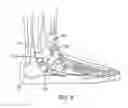 Fig. 09 - Articles of footwear with upper incorporating chamber element
