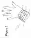 Fig. 05 - Multiple configuration string-like accessory